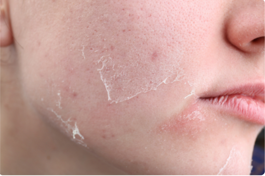 Hydration Purity Facial