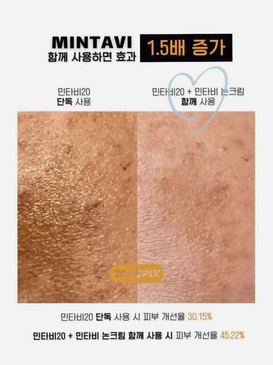ZOLOPIX Mintavi 20 Ampoule 26ml, Freckle and pore whitening