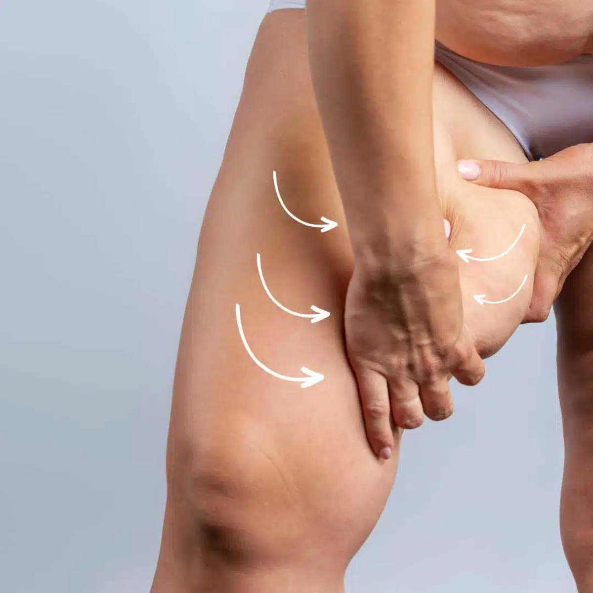 HIFU - Thighs