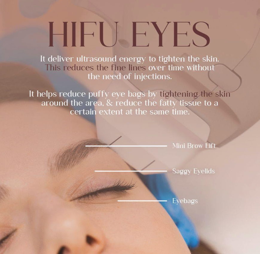 HIFU - eye lift