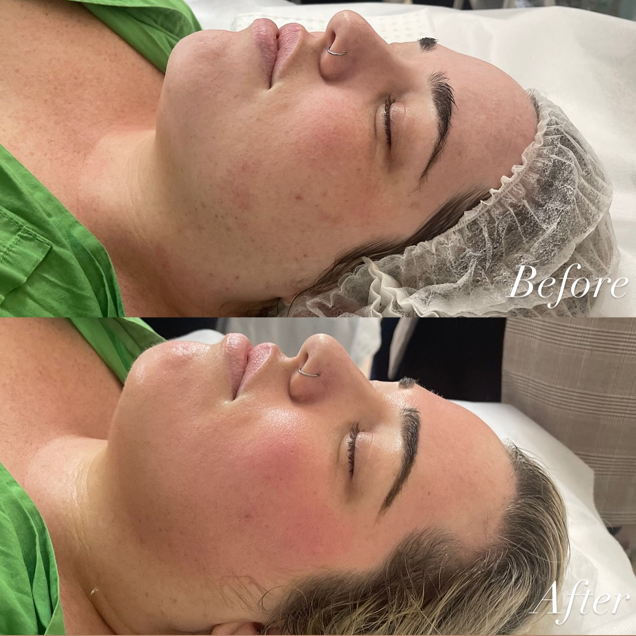 K-Glass Brightening Therapy