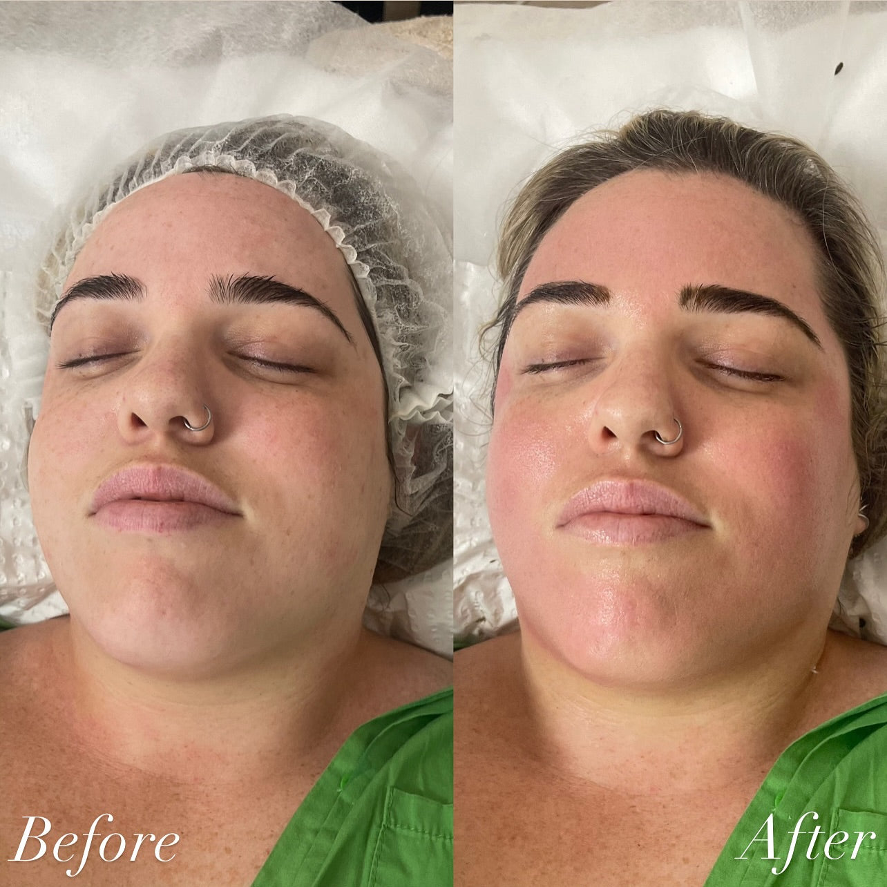 K-Glass Brightening Therapy