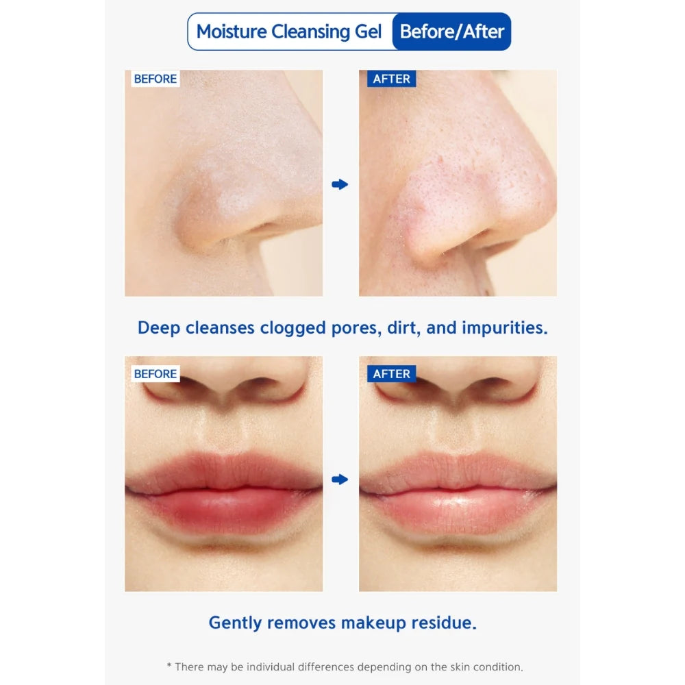 Dr Esthe Moisture Cleansing Gel – Gentle Hydrating Cleanser for Sensitive Skin