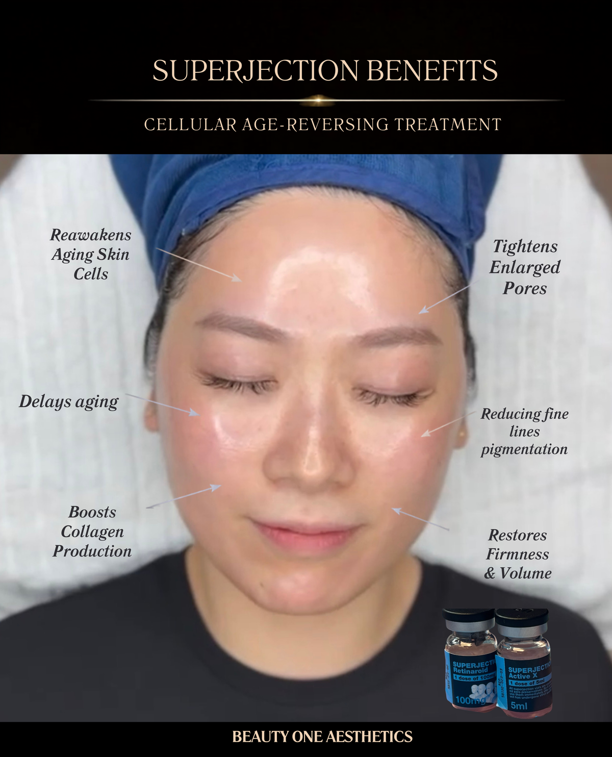 Superjection Retinaroid - Sept Sale