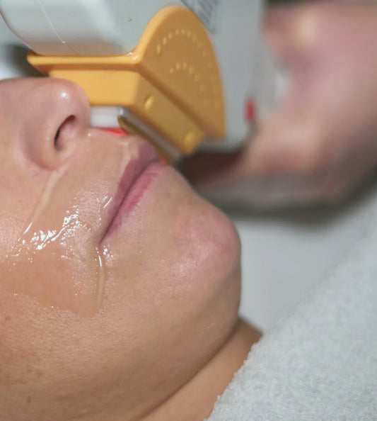 Hair Removal Lip + Chin