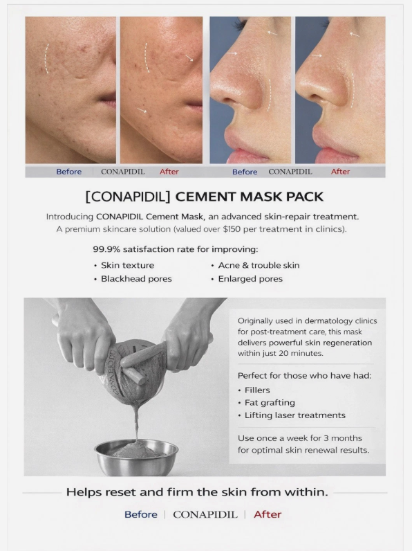 CemenSheet Super Conditioning Mask x 5