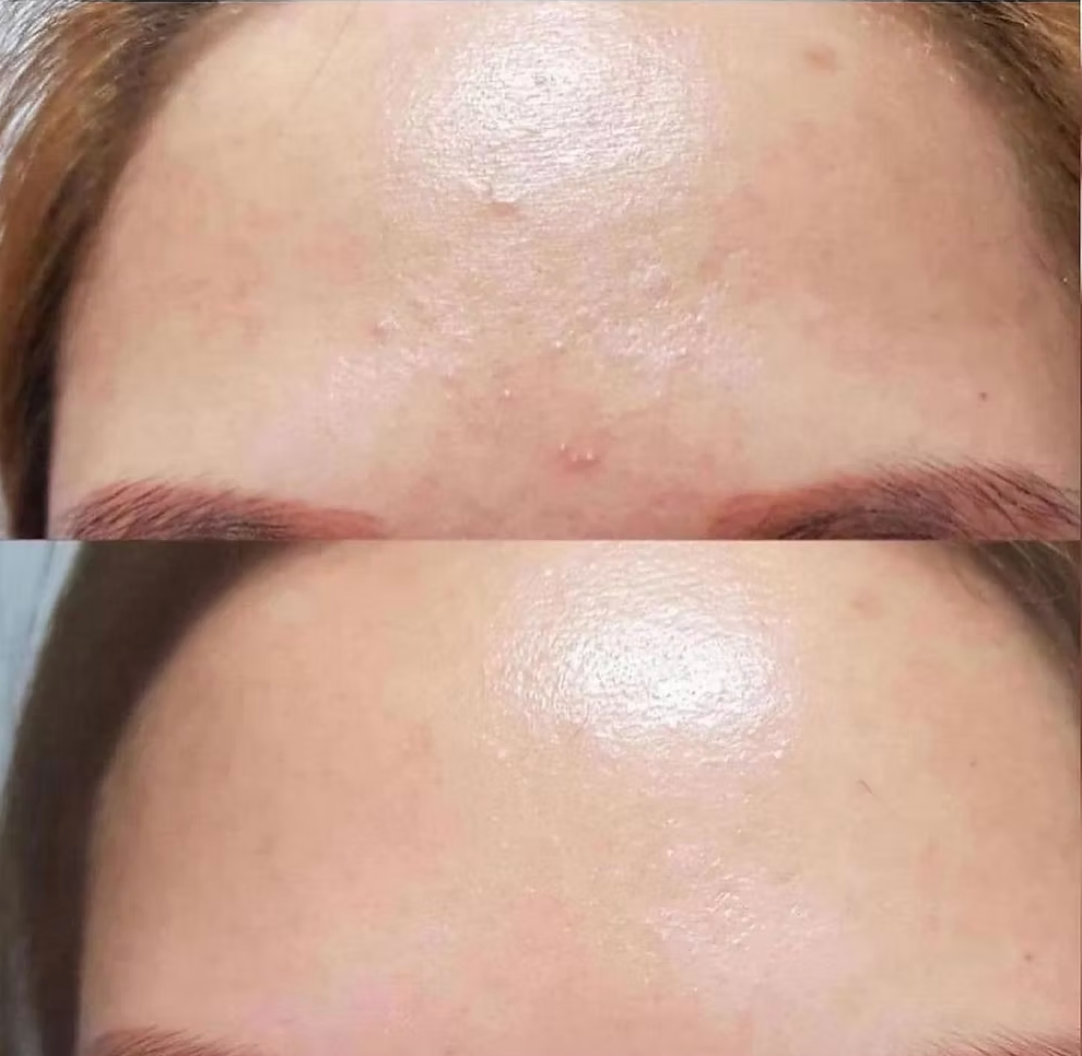 VQM VIBANQM Lotion