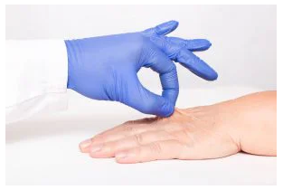 IPL Skin Rejuvenation - Hand