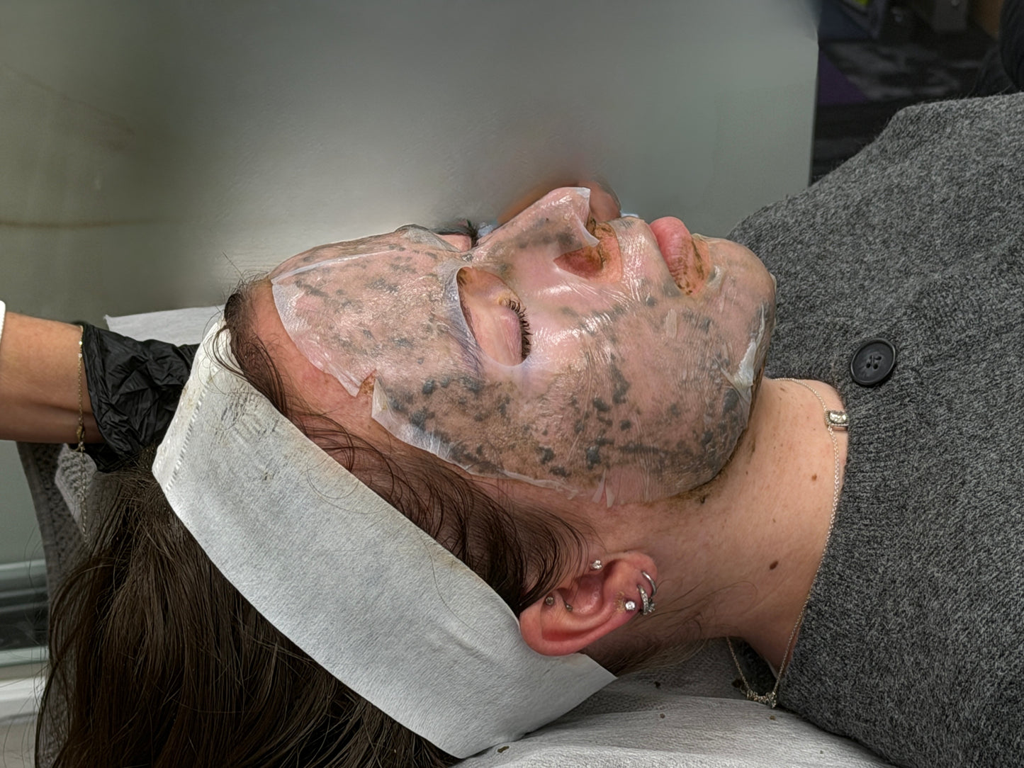 K-Acne Reset Therapy