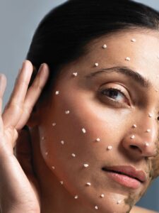 K- Skin Renewal Therapy